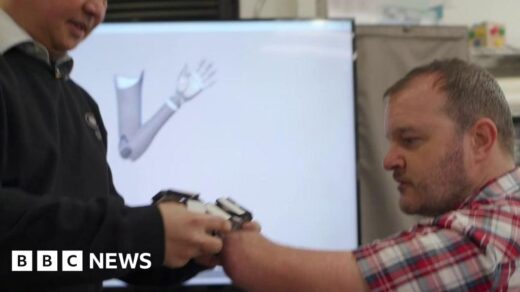 The AI-Powered Bionic Arm that Will Blow Your Mind