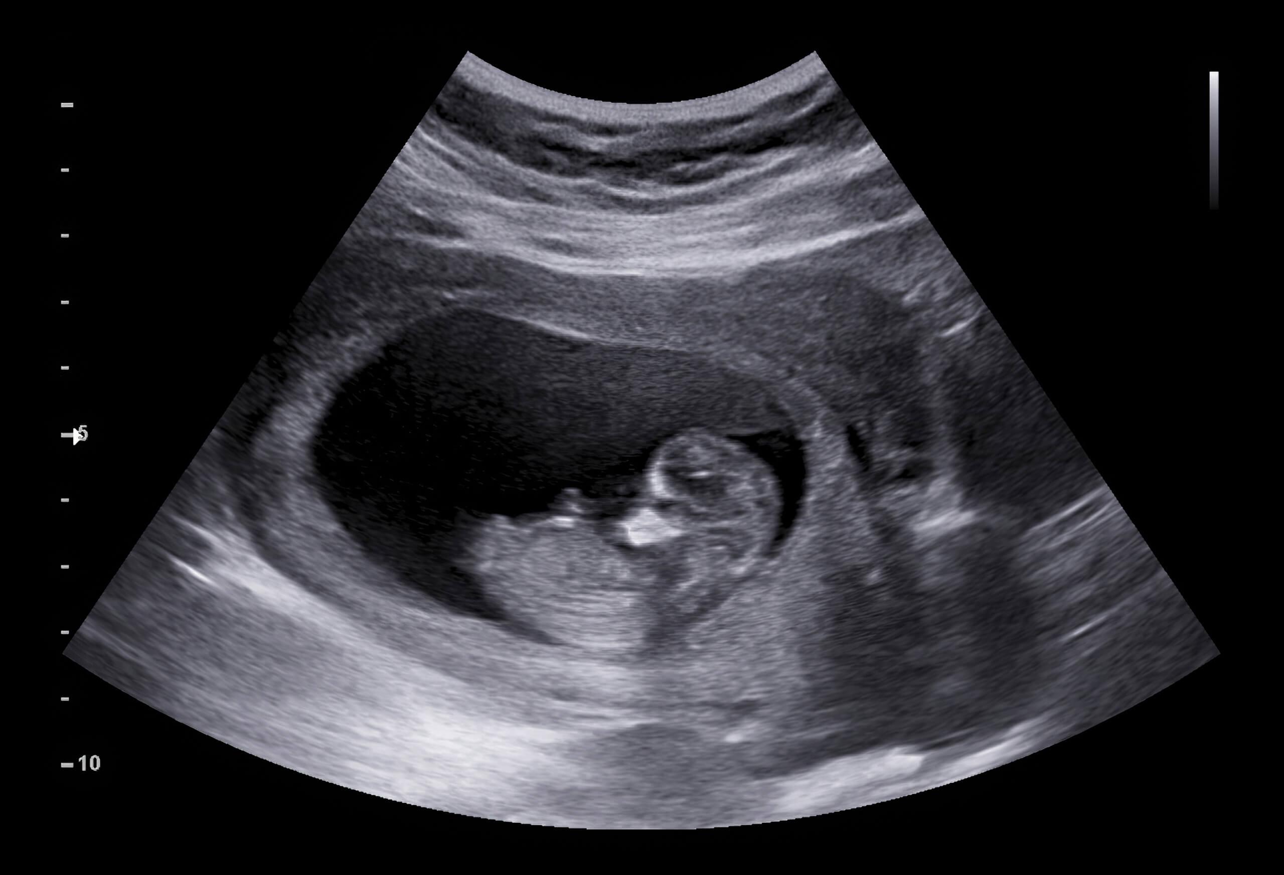 “The Ultrasound Tech Said, ‘Oh No, It Died'”: People Who Have Been Pregnant Before Are Sharing The Most Outrageously Unacceptable Things People Have Ever Said To Them