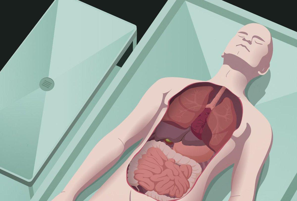 Autopsy Professionals Are Revealing The Most Bizarre Anomalies They've Seen, And Wow, The Human Body Is Truly A Wonder