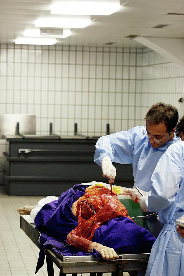 Autopsy Professionals Are Revealing The Most Bizarre Anomalies They’ve Seen, And Wow, The Human Body Is Truly A Wonder
