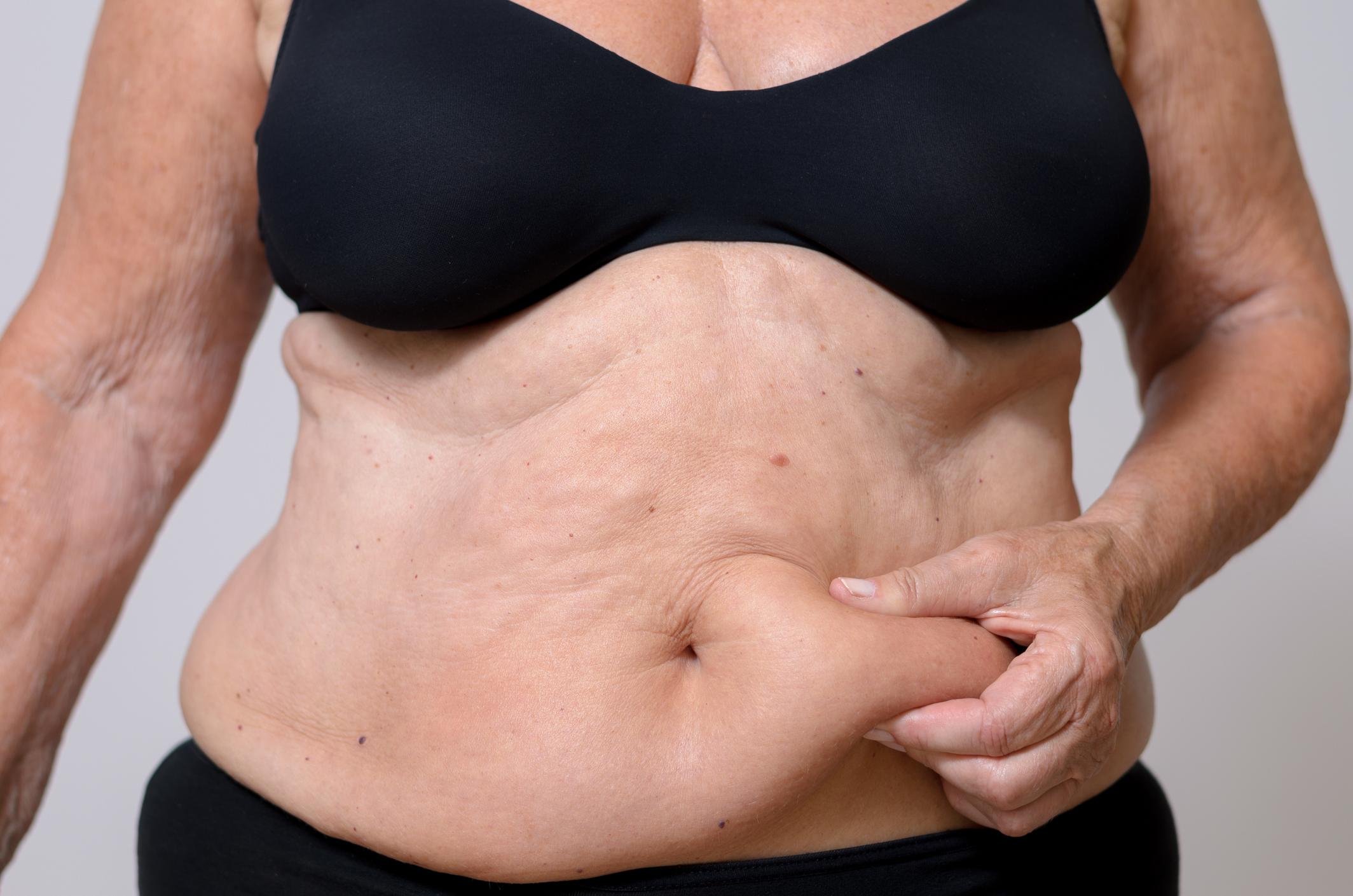 How To Lose Lower Belly Fat After 50—Without Calorie-Counting or Crunches How To Get Rid of Stubborn Lower Belly Fat for Good: Pro Tips for Women Over 50