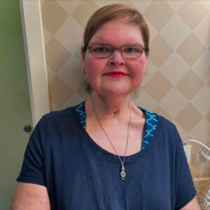 Tammy Slaton’s Excess Skin Removal Before & After Photos: See Her Transformation (Exclusive)